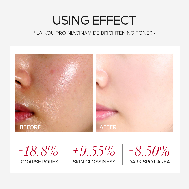 LAIKOU PRO Niacinamide 4Pcs Br - Niacinamide Brightening Serum review and price