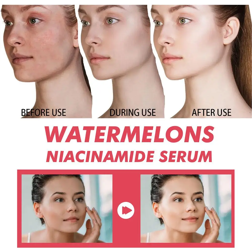 Watermelon Glow Niacinamide Mo - Niacinamide Brightening Serum review and price