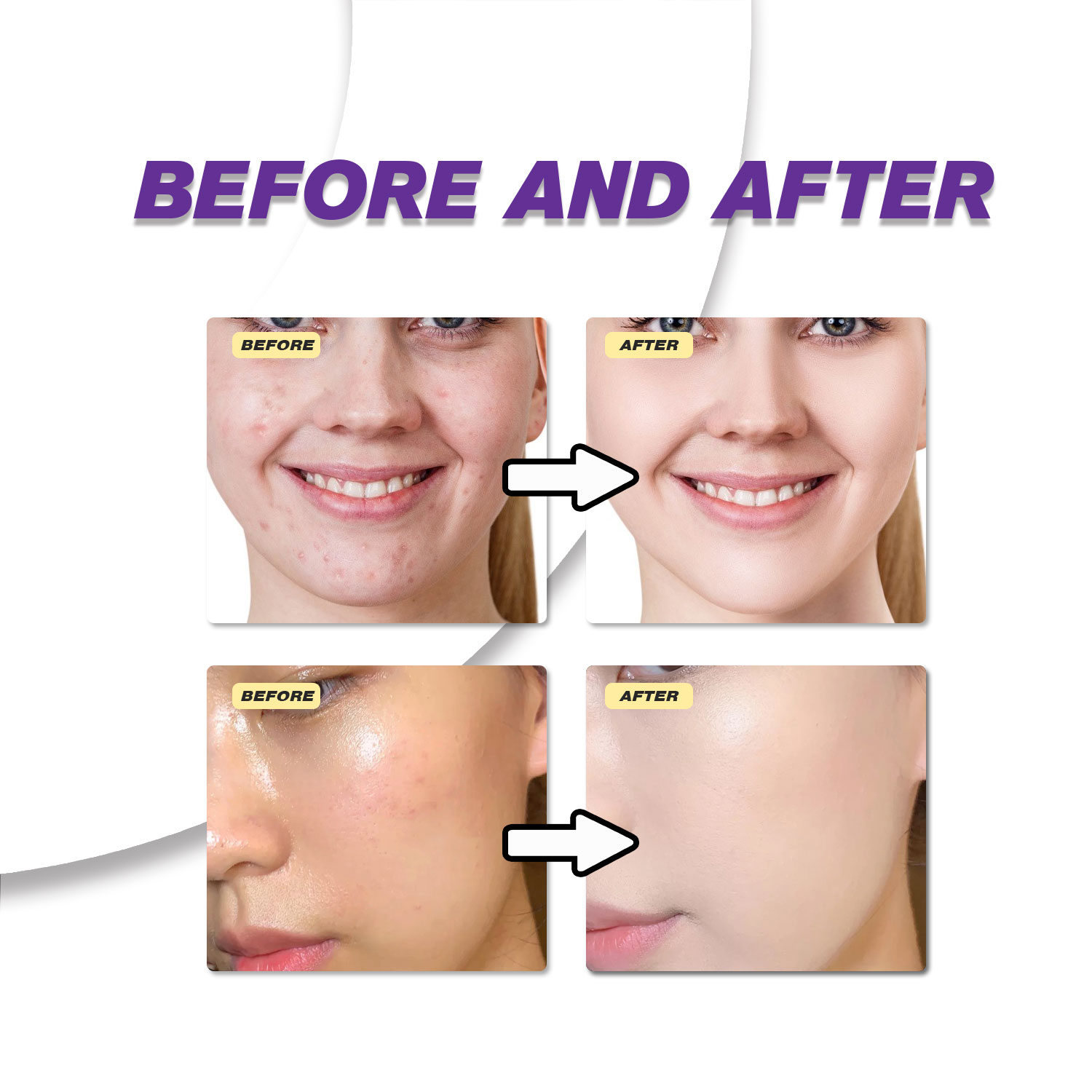 Mild Azelaic Acid Cream Improv - Skincare Skintific review and price