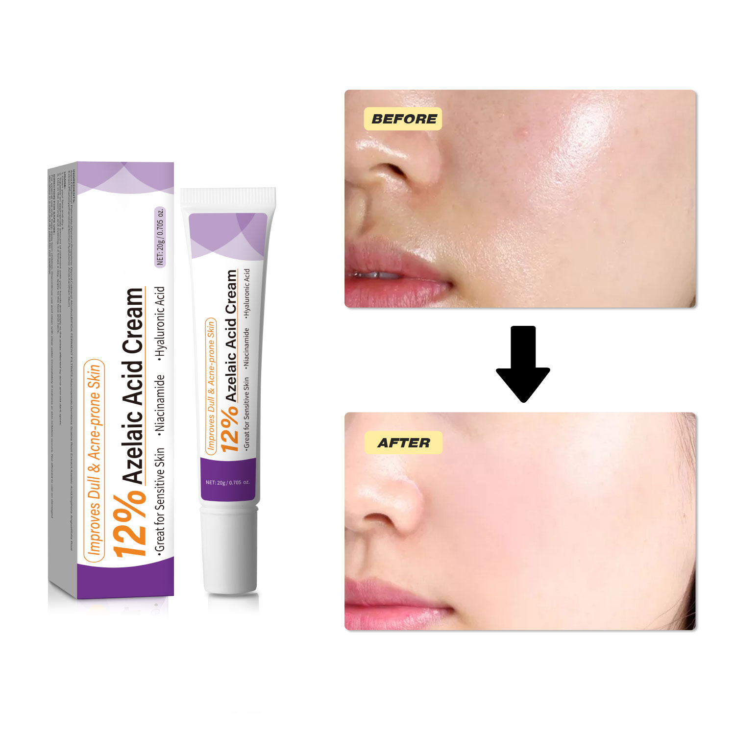Mild Azelaic Acid Cream Improv - Skincare Skintific review and price