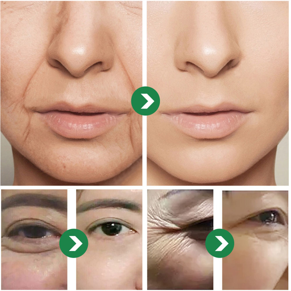 50g Japanese Six peptides Crea - Eye Cream Peptide review and price