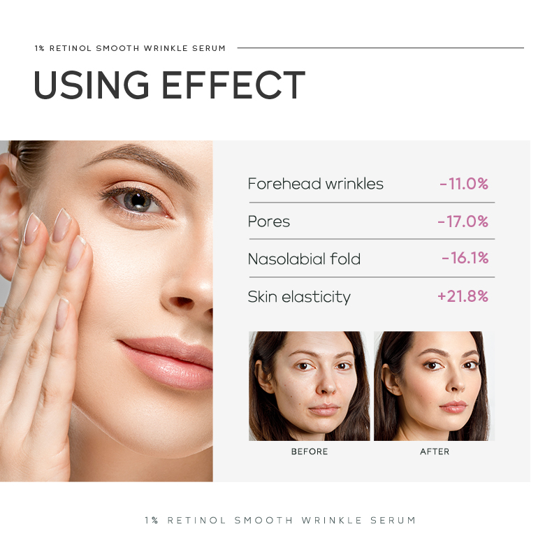 Quiyum 1% Retinol Smooth Wrink - Niacinamide Brightening Serum review and price